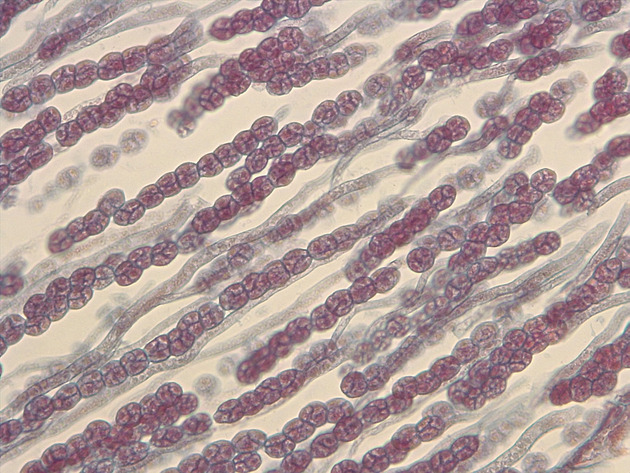 Liverwort Sporophyte Slides - Liverwort Sporophyte 03 400X